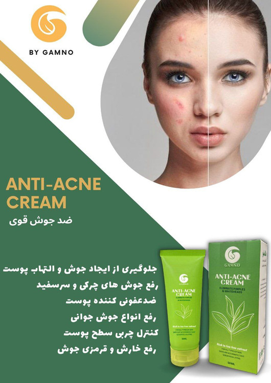 کرم تخصصی ضد جوش اورژانسی رفع جوش های چرکین صورت کرم تخصصی و درمان قطعی انواع آکنه،رفع جای جوش وقرمزی،